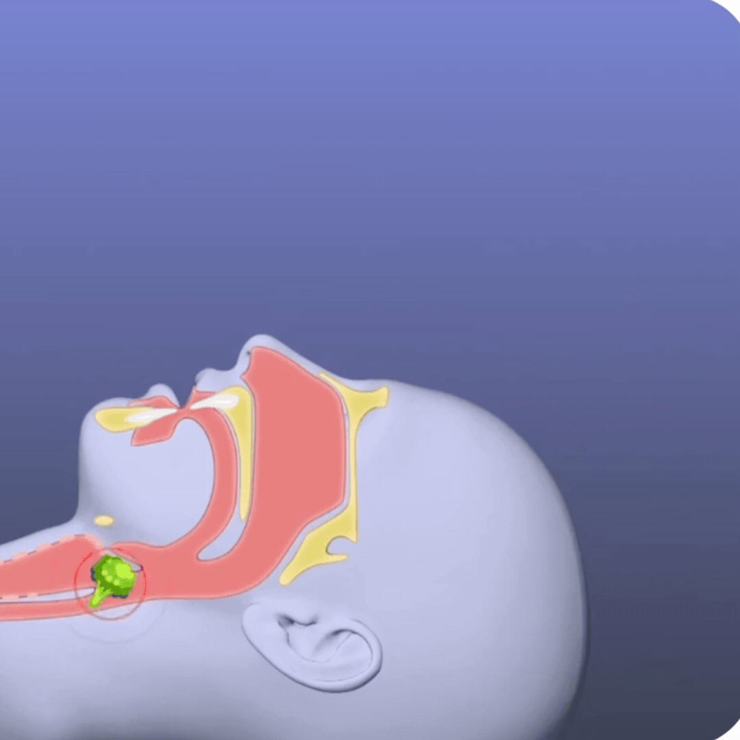 Vitals│tu Plan B ante un atragantamiento
